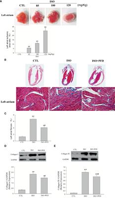 Isoproterenol Increases Left Atrial Fibrosis and Susceptibility to Atrial Fibrillation by Inducing Atrial Ischemic Infarction in Rats